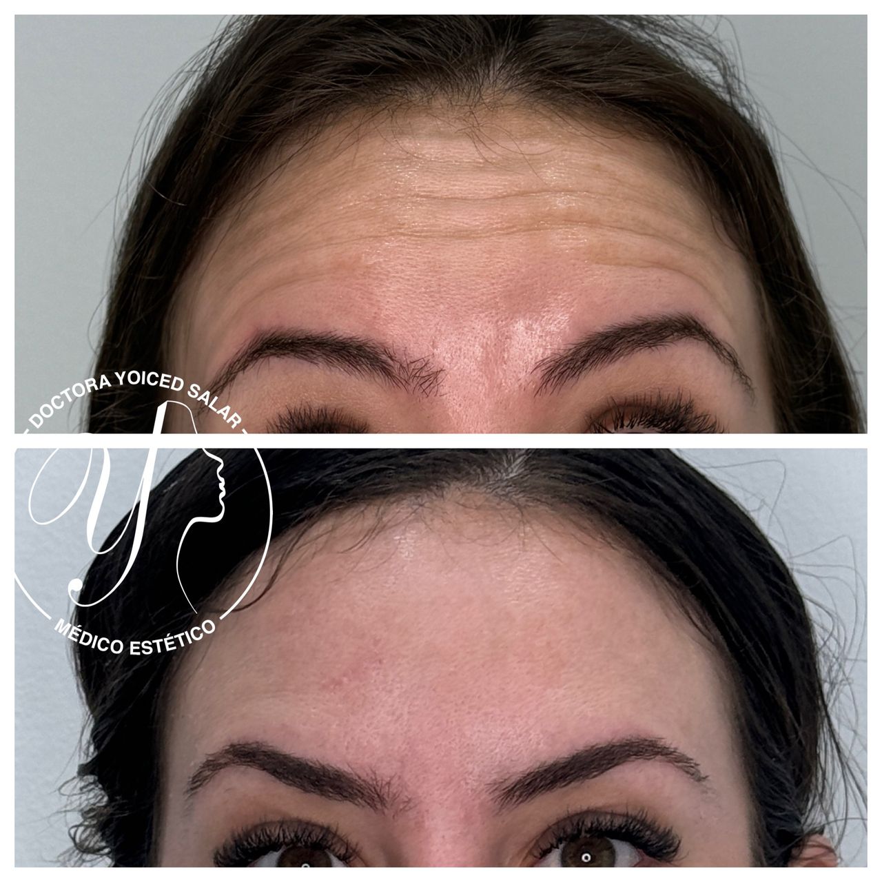 Yoiced Salar Peñate-34