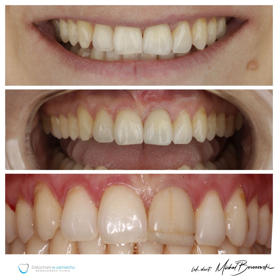 Michał Berezowski-34