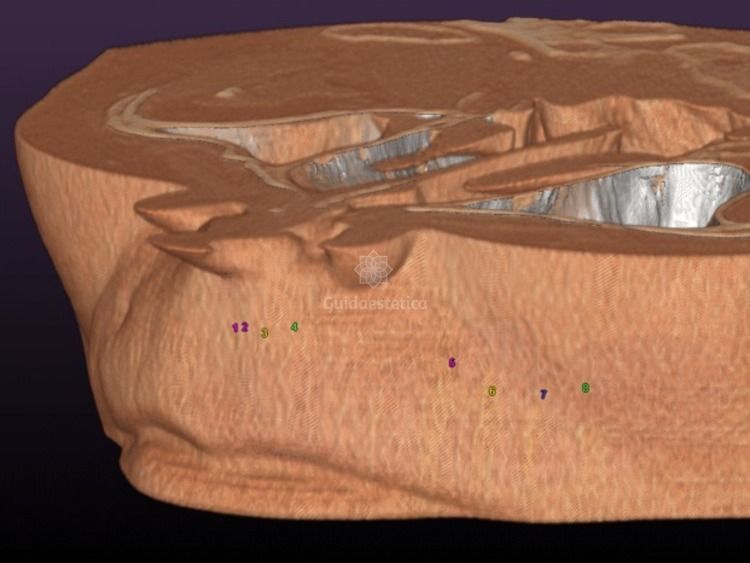 Alessandro Palumbo-58