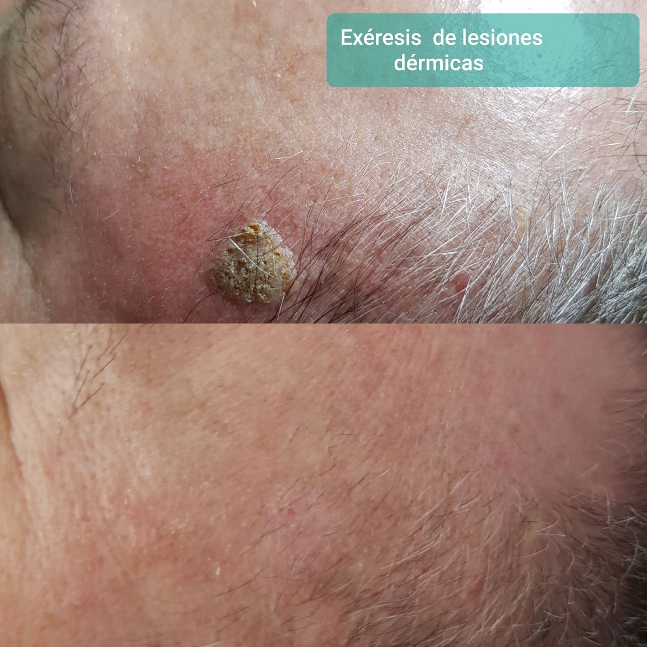 Rosalba Herrero Zerpa-353