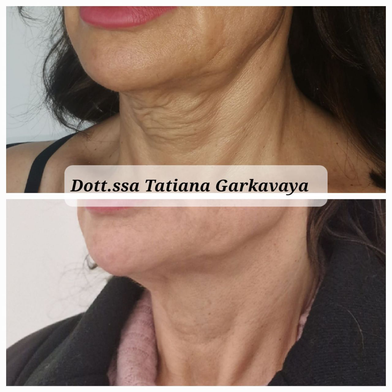 Tatiana Garkavaya-11