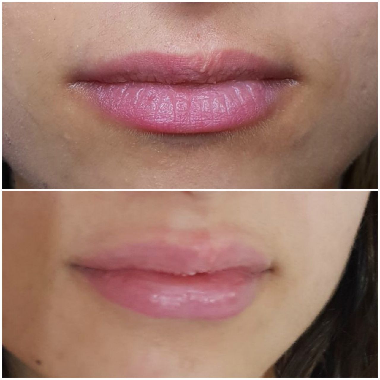 Antonio Calopresti-0