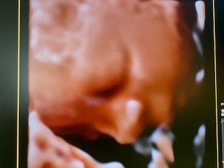 Domenico D'assisi-19