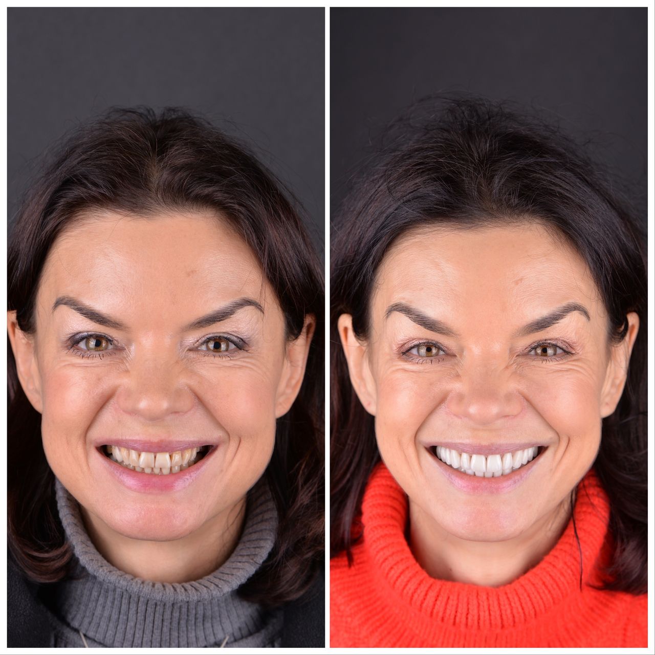 Martin Bartoszcze-15