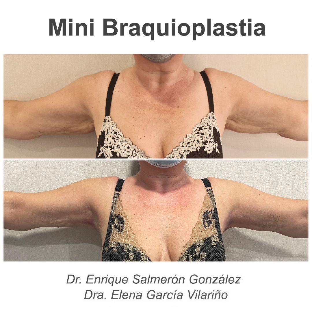 Enrique Salmerón González-49