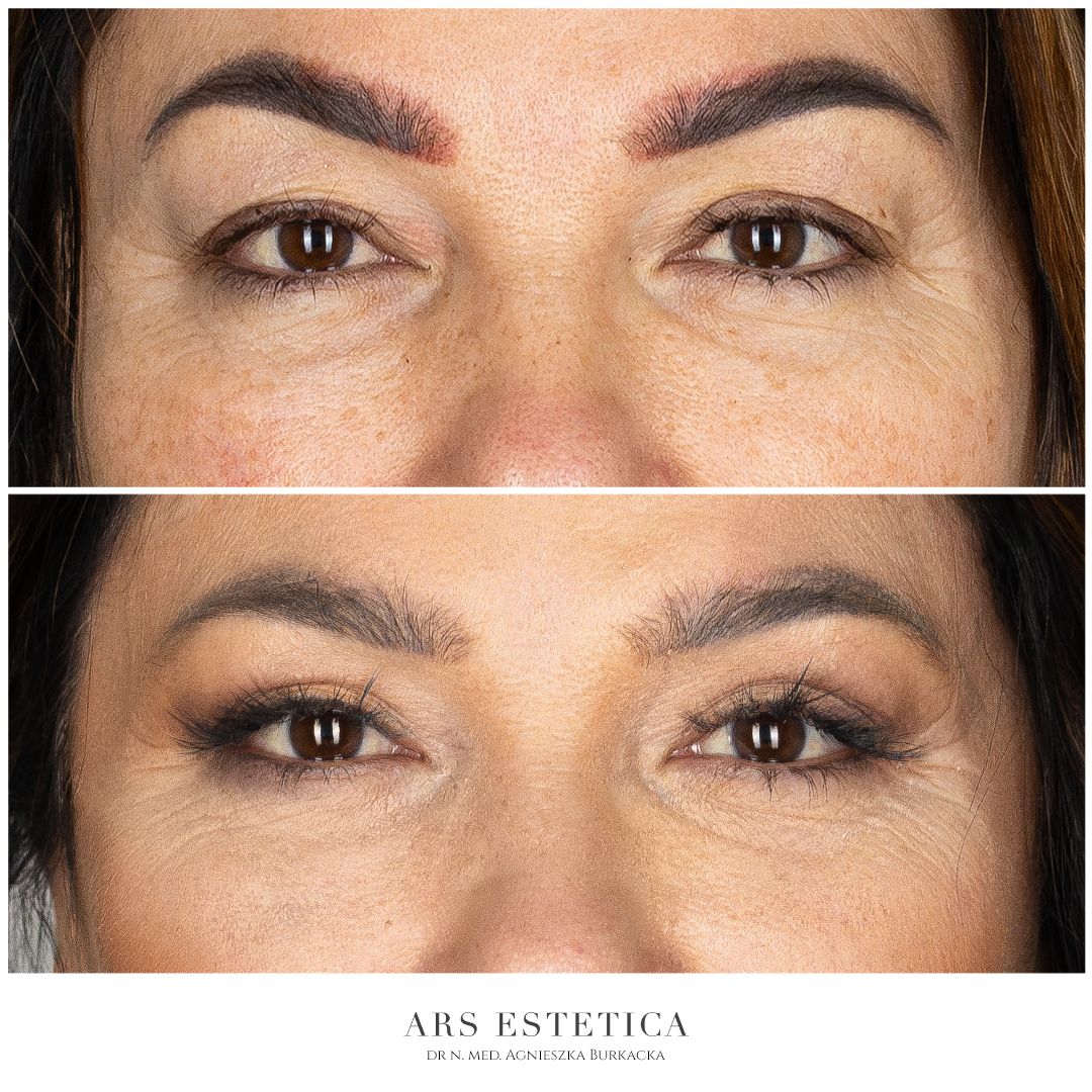 Agnieszka Burkacka-1