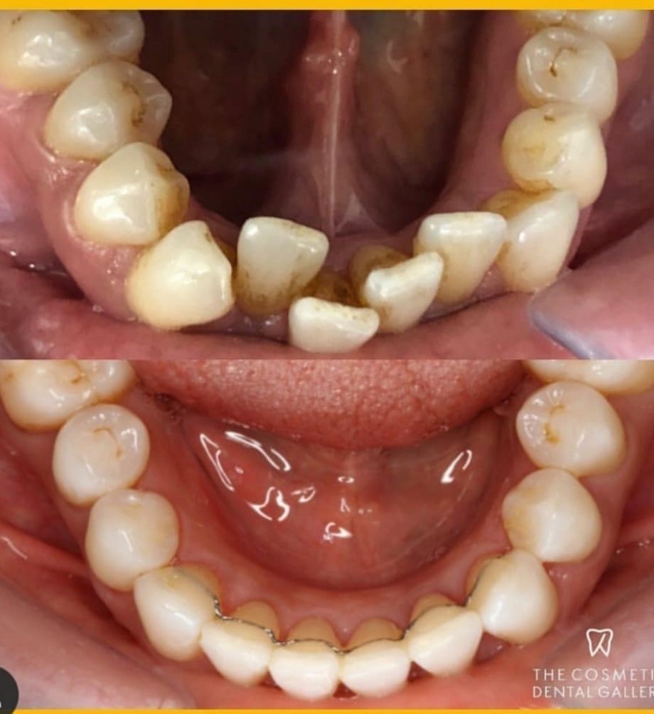 Alessandro Neglia-23