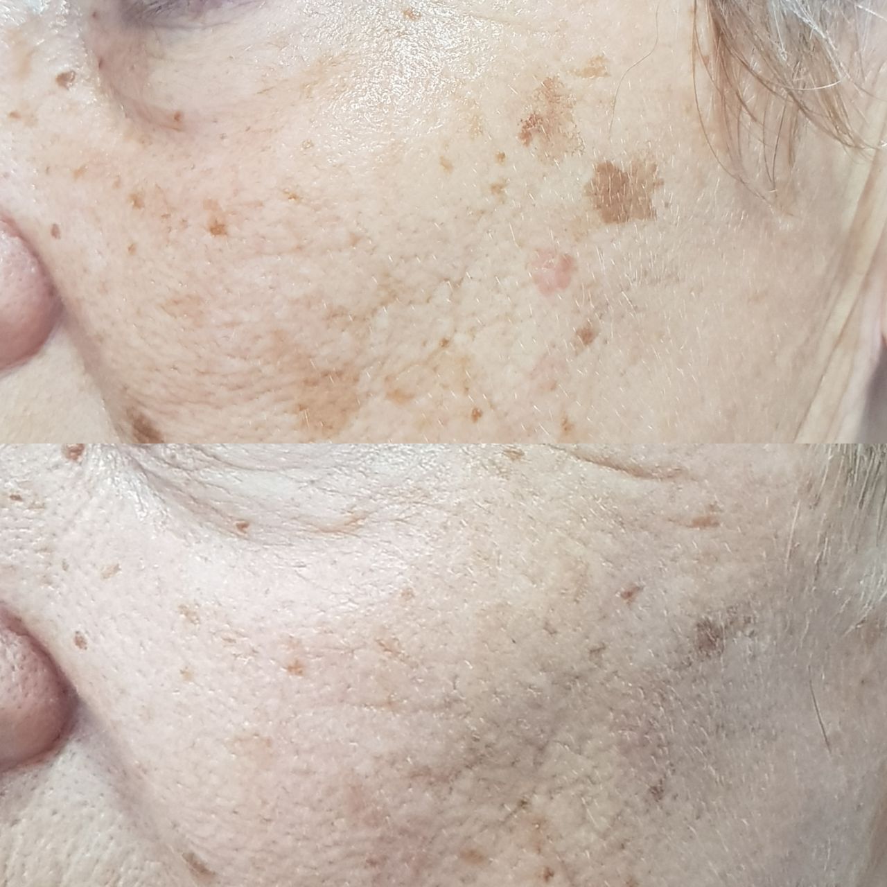 Rosalba Herrero Zerpa-298