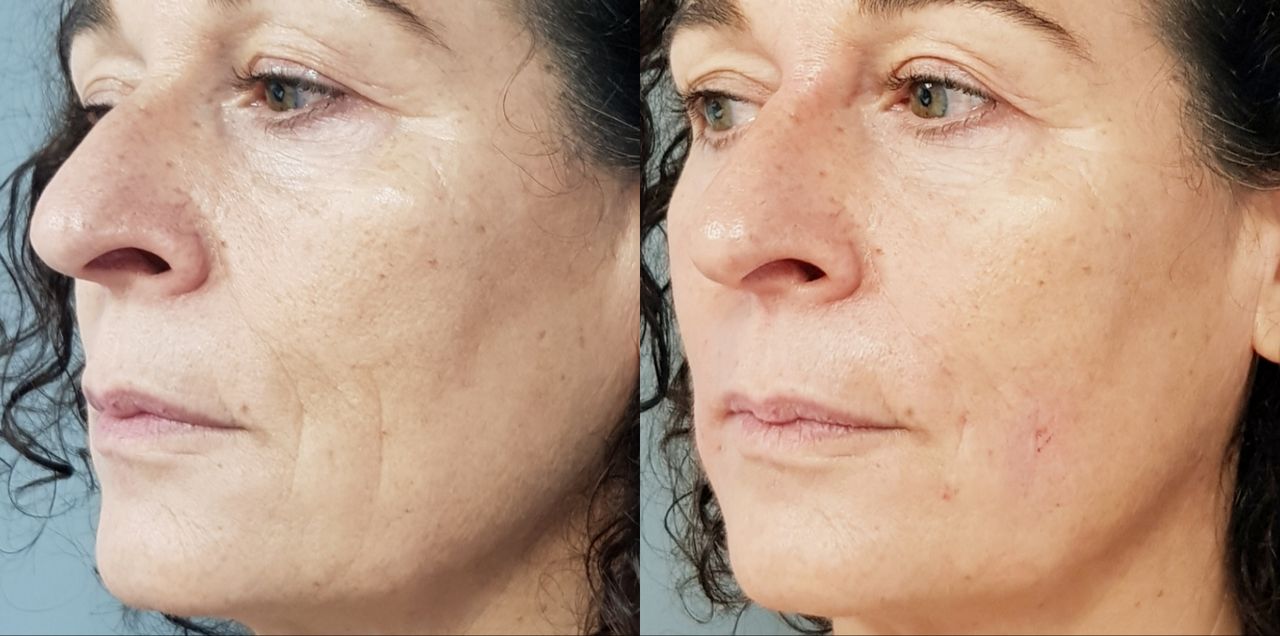 Rosalba Herrero Zerpa-491