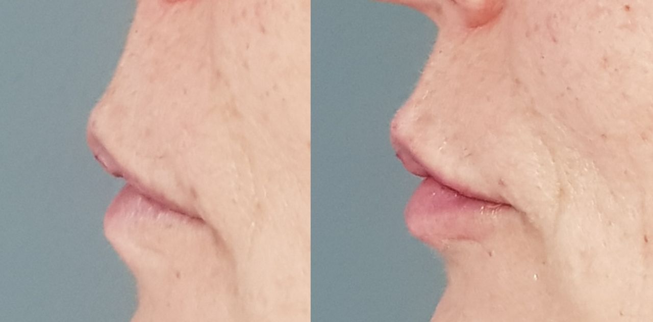 Rosalba Herrero Zerpa-55