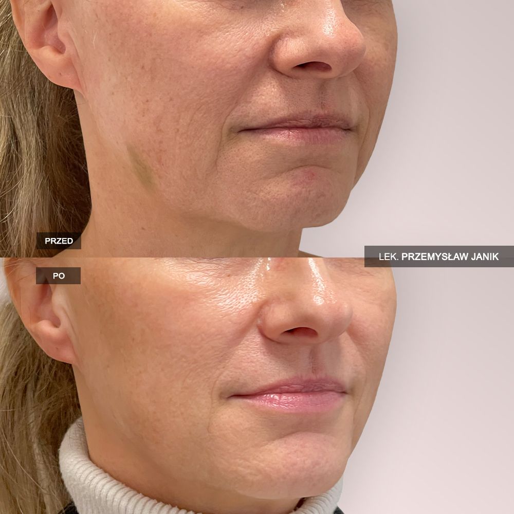 Przemysław Janik-37