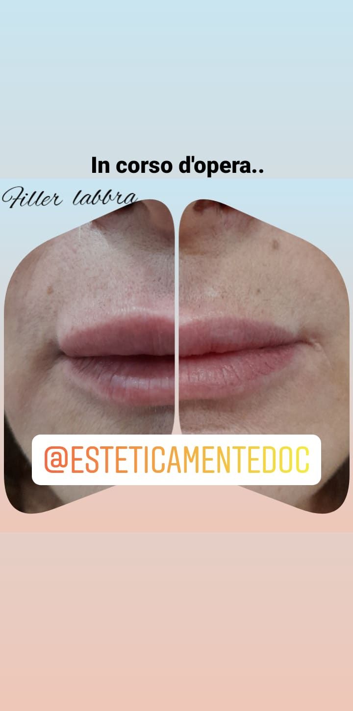 Paola Della Rocca-53