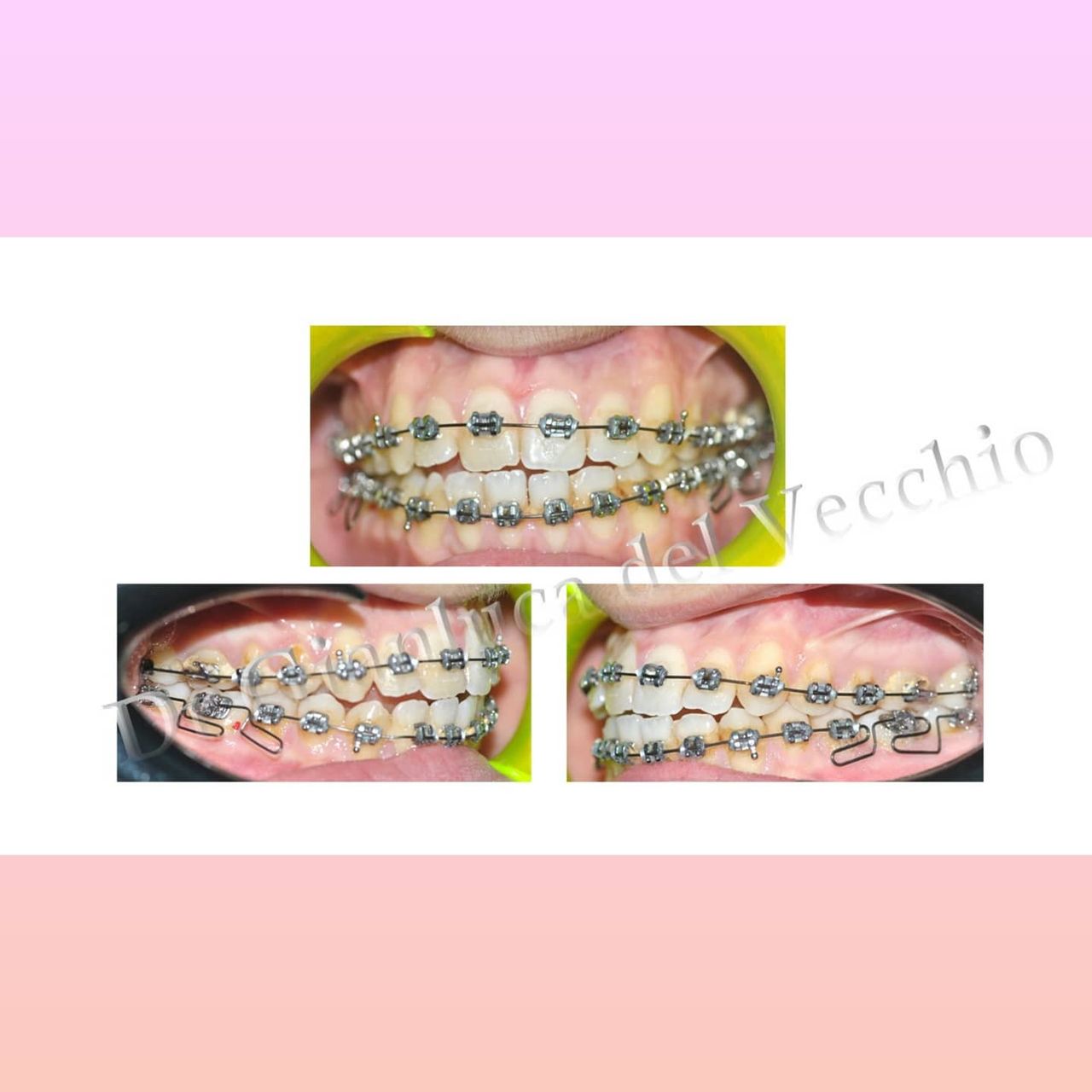 Gianluca Del Vecchio-63