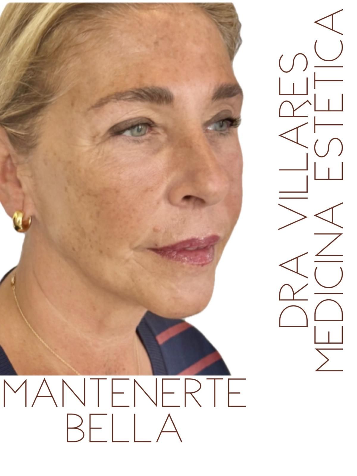 Maria Jose Villares Moreno-3