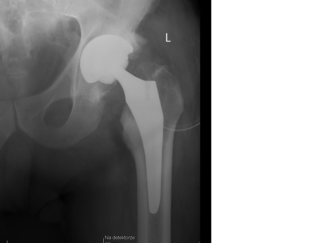 Mateusz Orzechowski-9