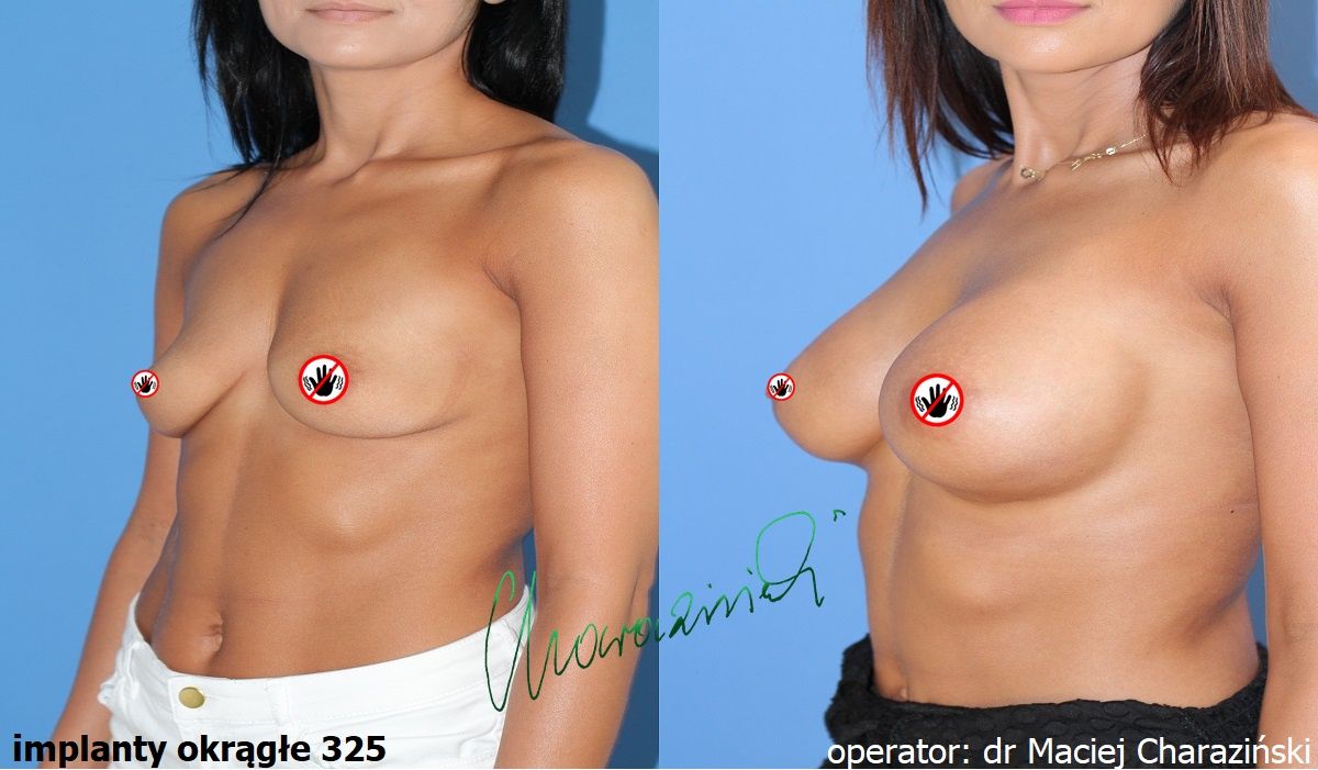 Maciej Charaziński-7