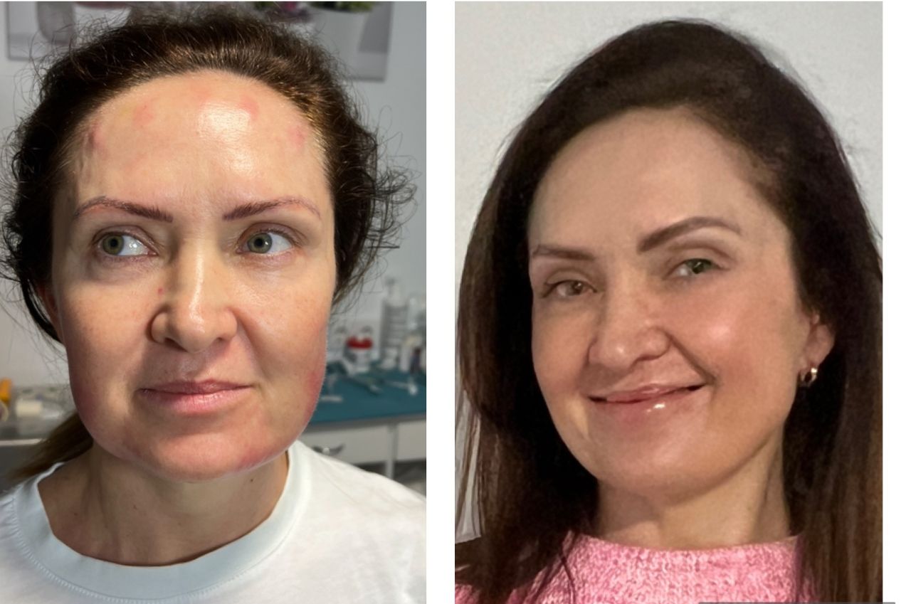 Humberto González Sánchez-12