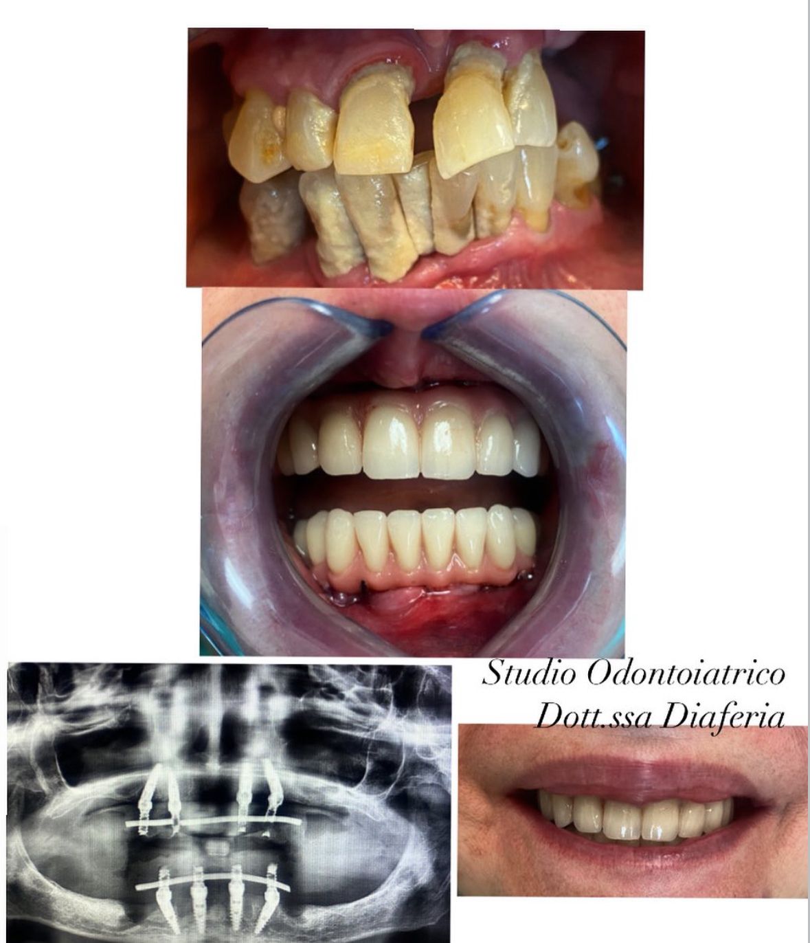 Maria Grazia Diaferia-39