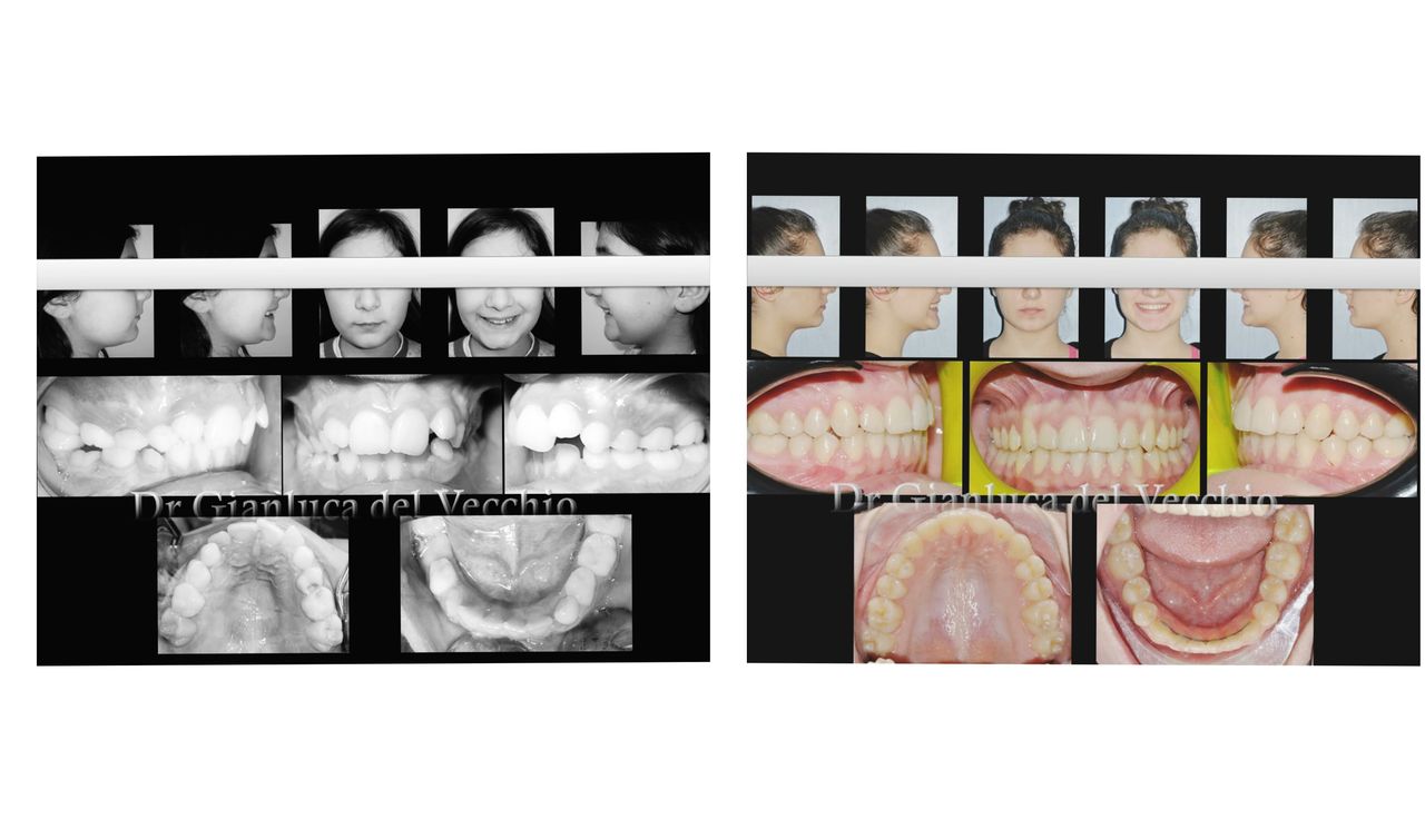 Gianluca Del Vecchio-58