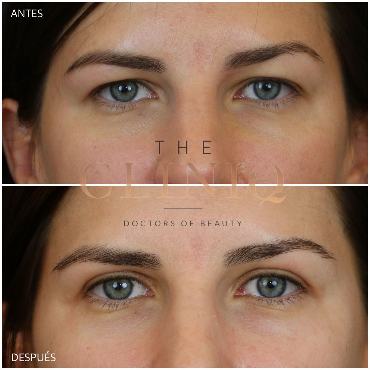 Ignacio Genol Saavedra-3