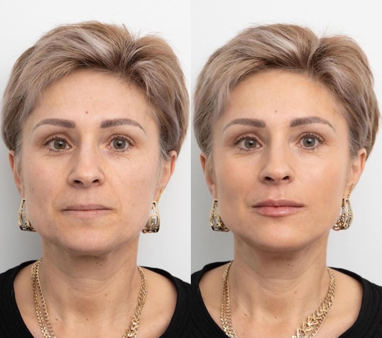 Raquel Moreno Pentinel-79