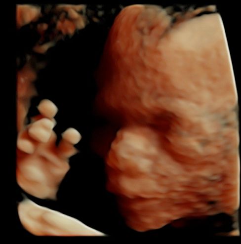 Tommaso Incandela-34