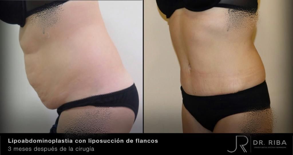 Jordi Riba Vilchez-30