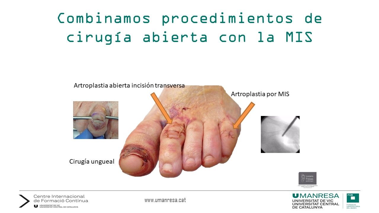 Joan Lozano Freixas-19