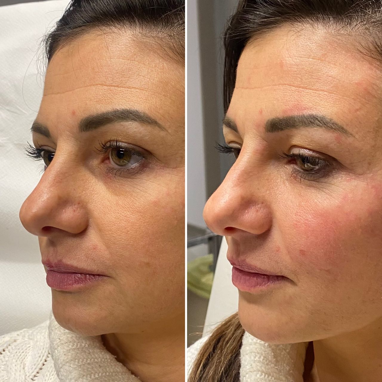 Valerio Lorenzano-13