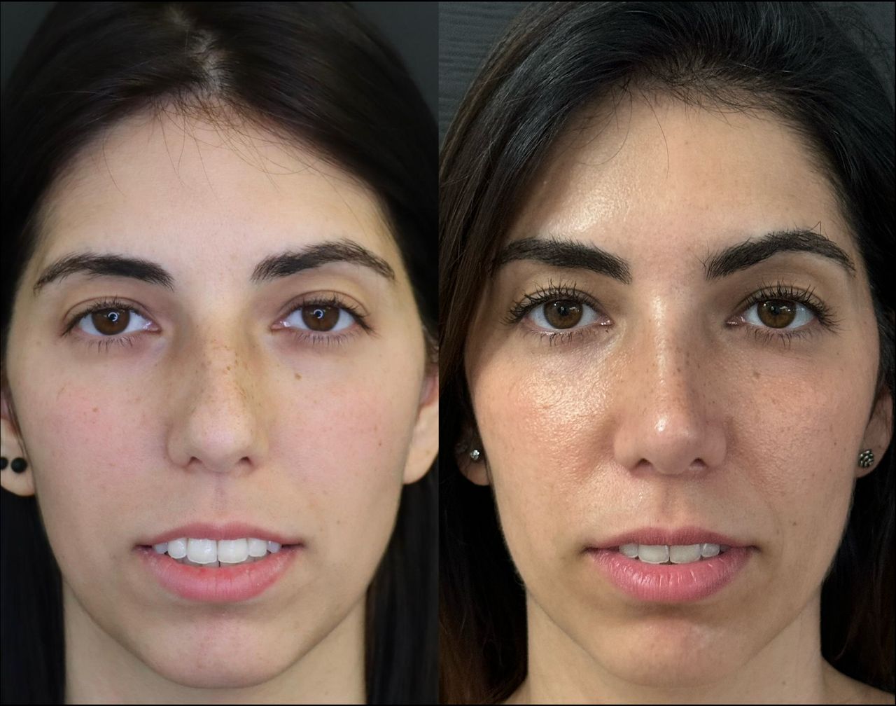 Pier Paolo Ferretti-1