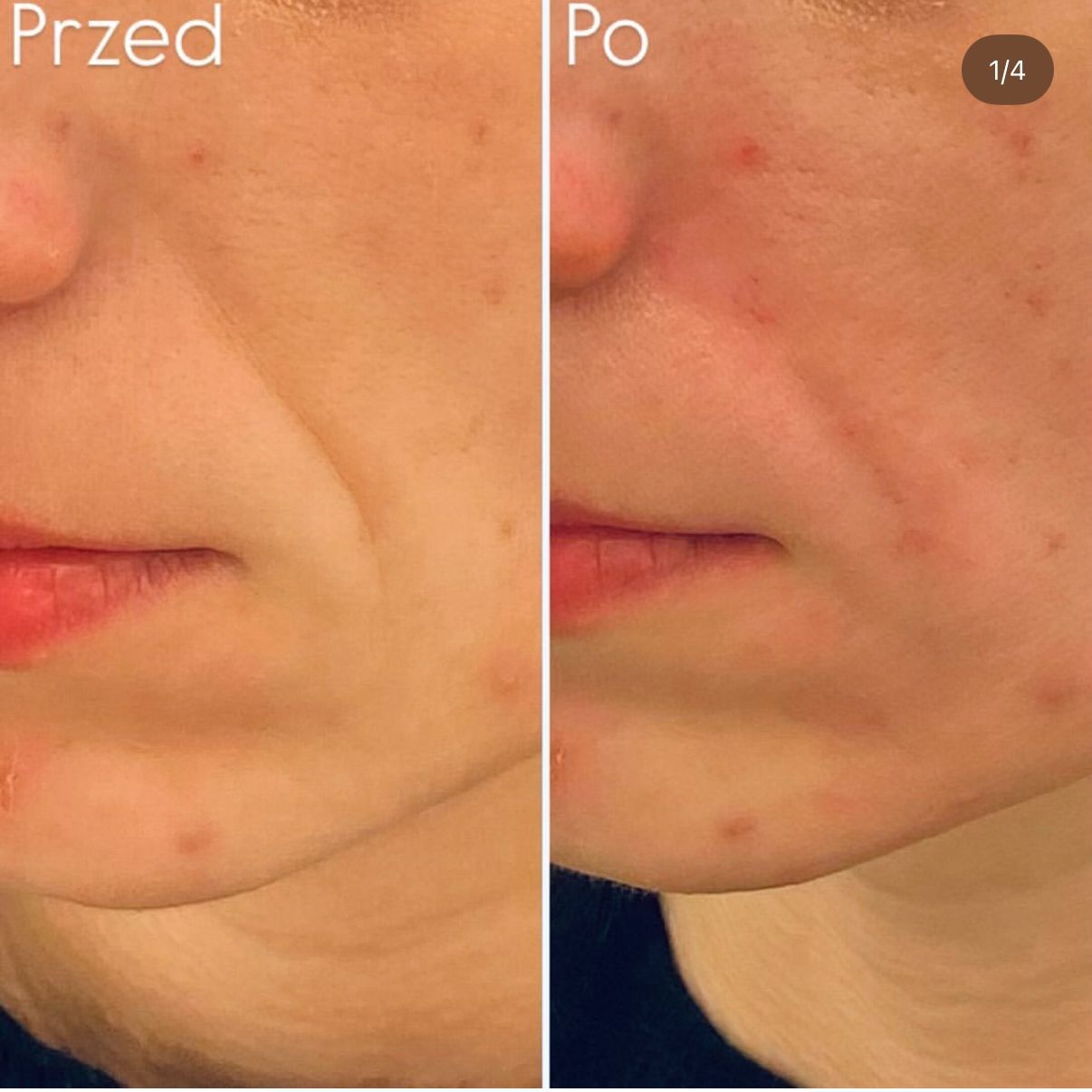 Aleksandra Kowalczuk-21