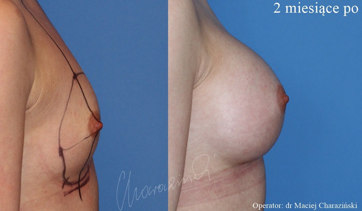 Maciej Charaziński-97