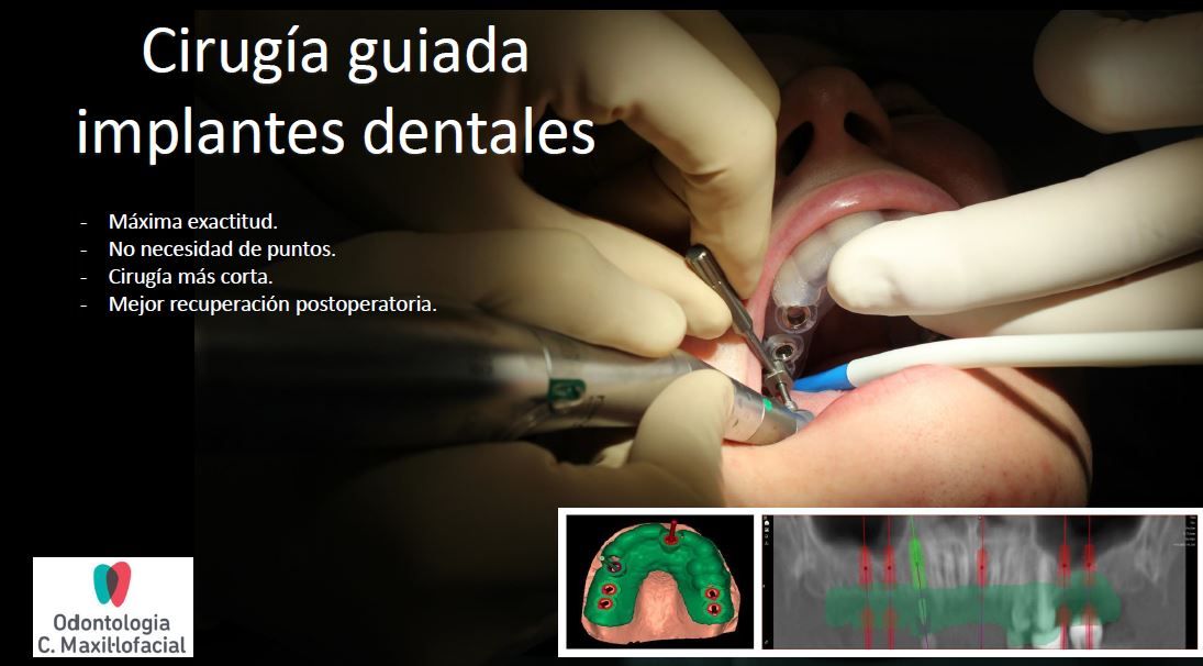 Alfonso Mogedas Vegara-4