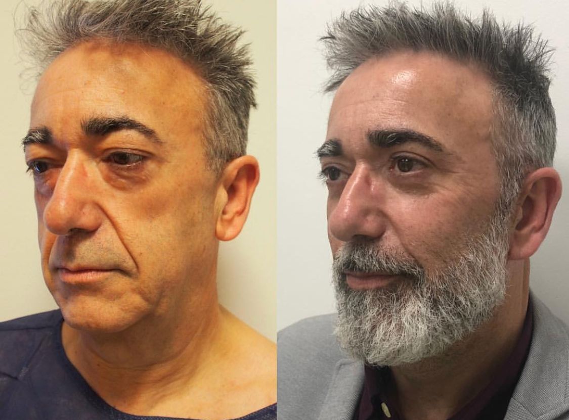 Alberto Candau Álvarez-38