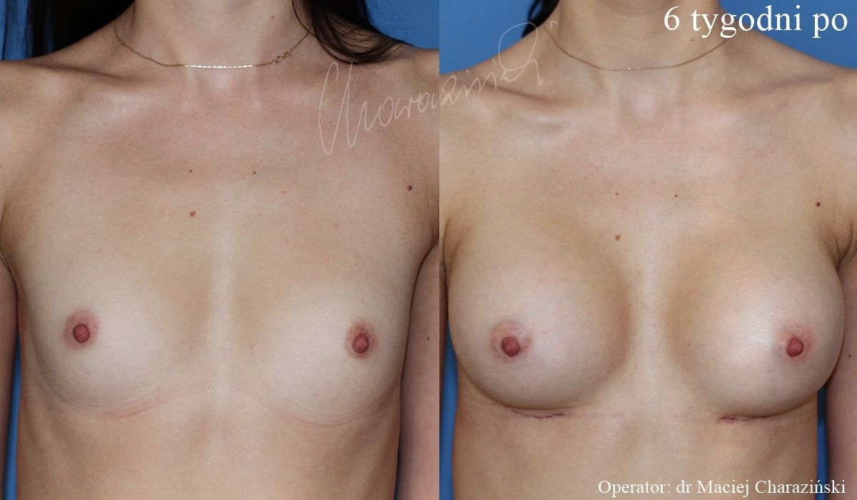 Maciej Charaziński-93