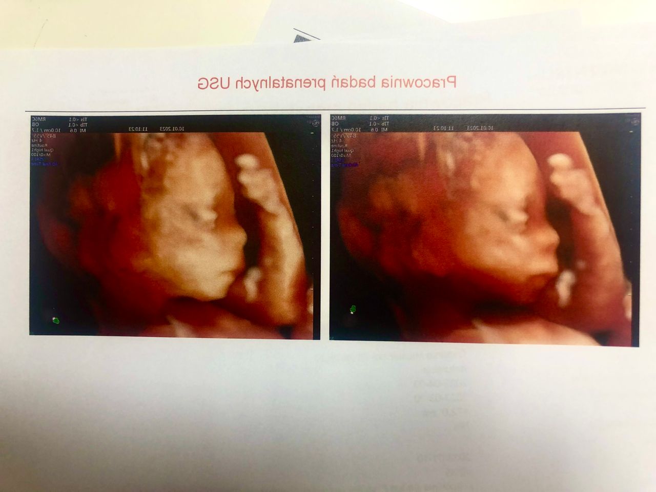 Wioletta Rozmus-Warcholińska-23