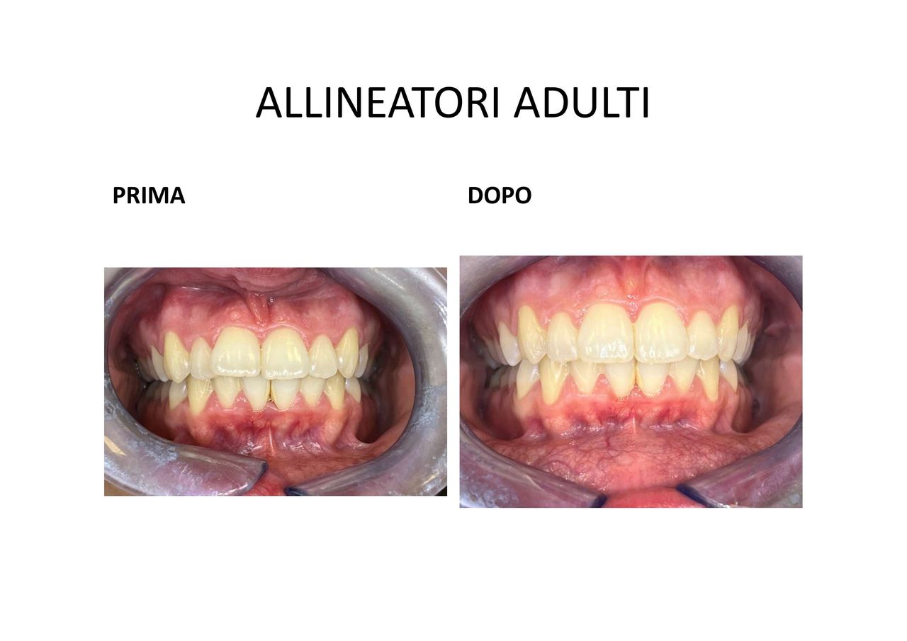 Raffaella Ferraris-12