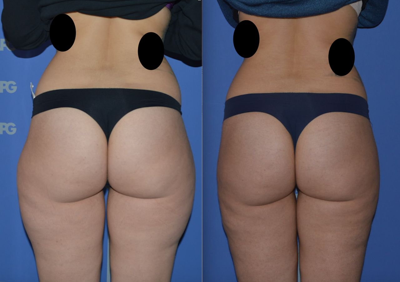 Michele Antonacci-13