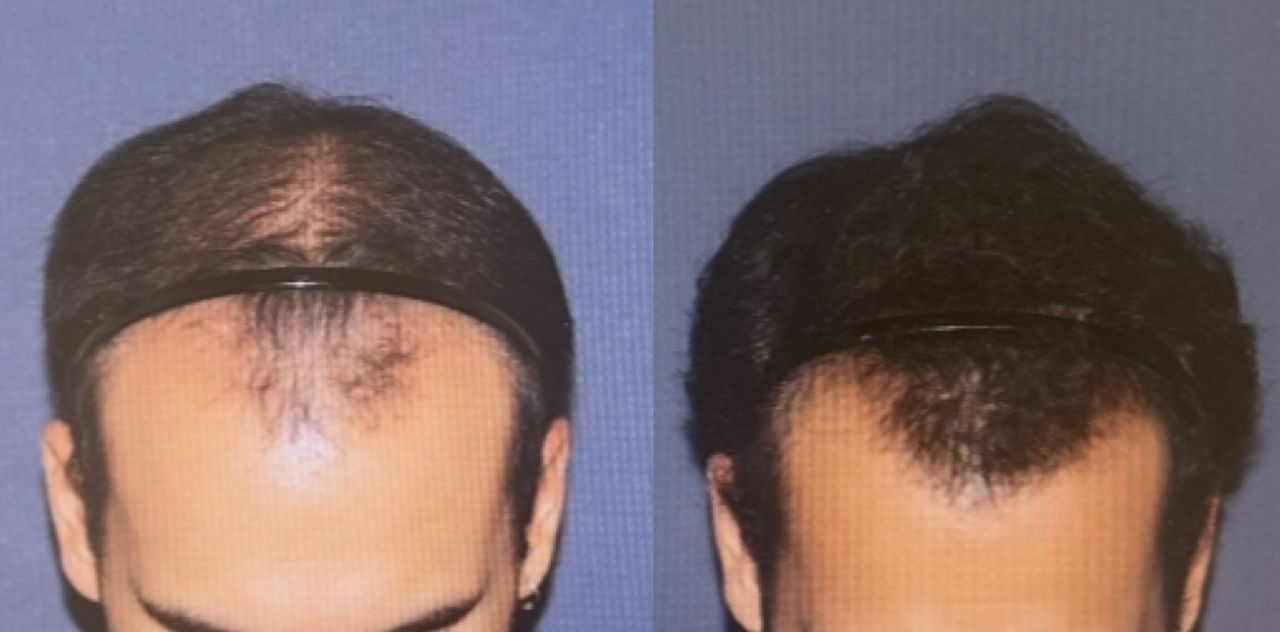 Manuel Ballesteros Redondo-1