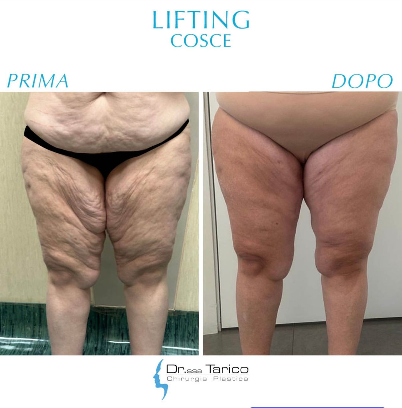 Maria Stella Tarico-13