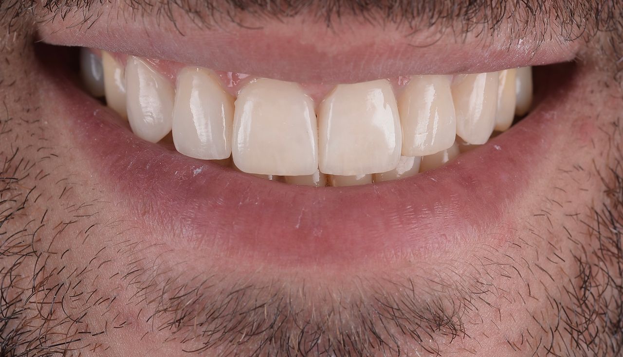 Riccardo Giardina-16