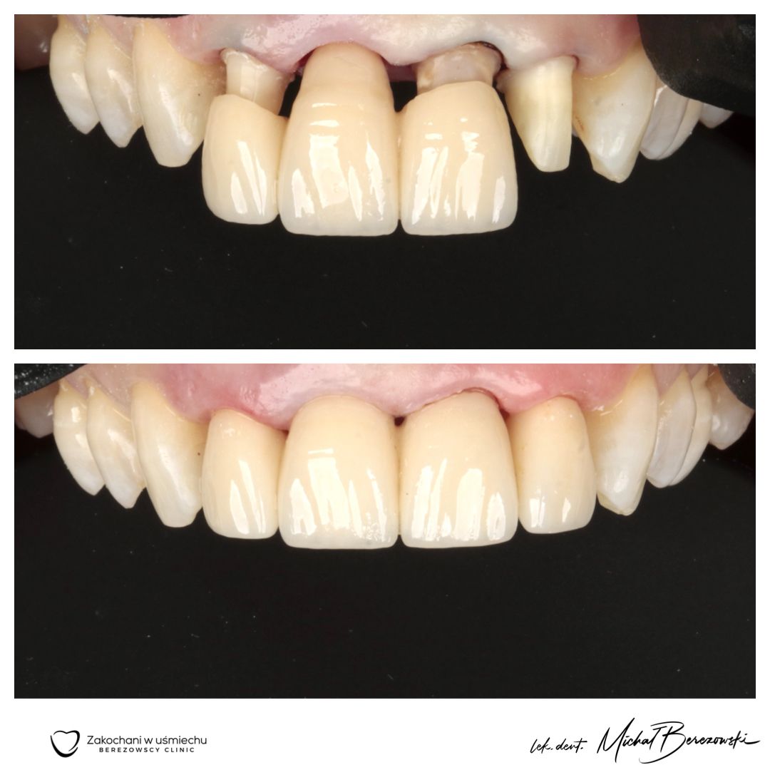 Michał Berezowski-23