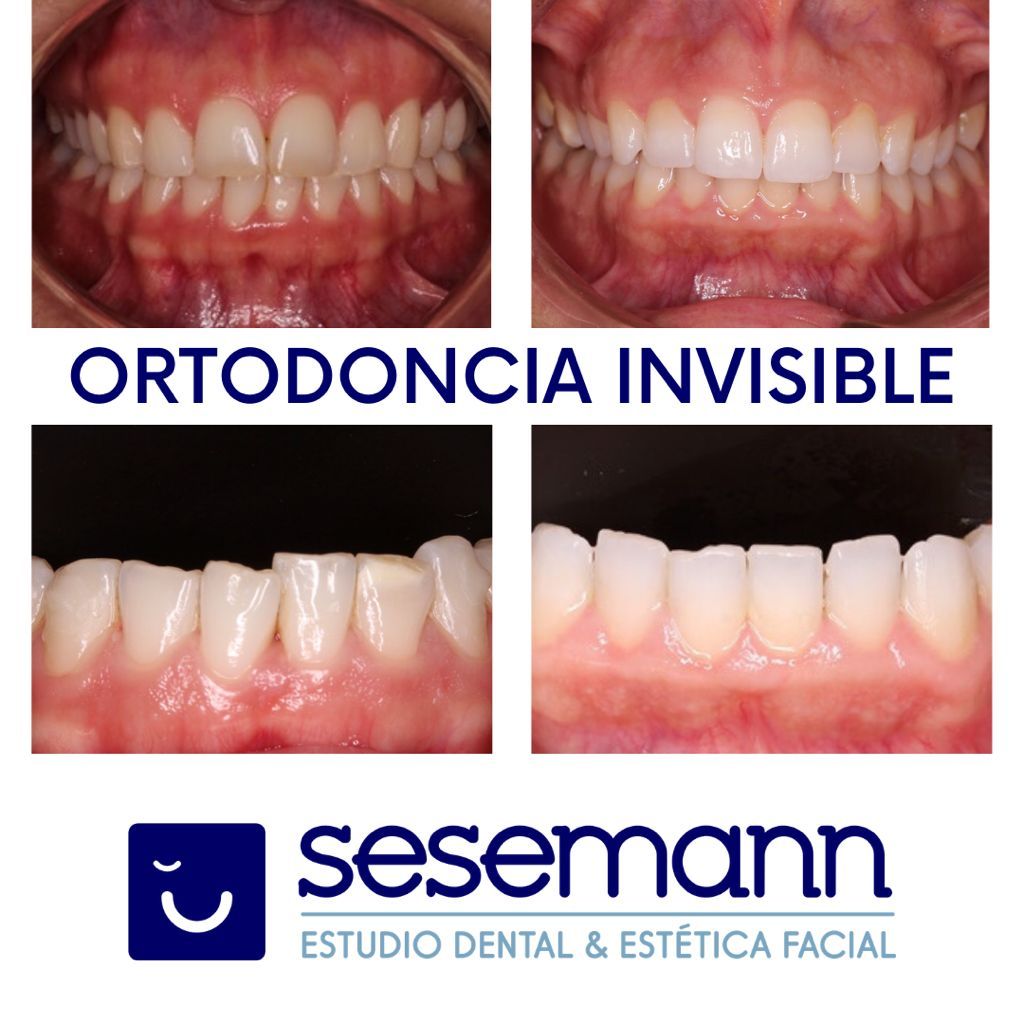 Paula Cano Carrillo-96