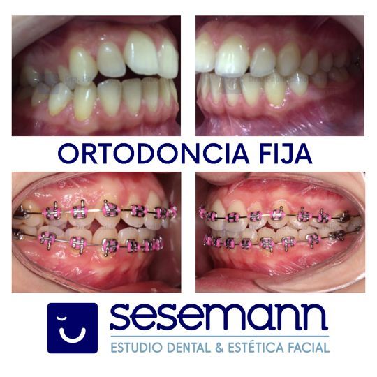 Paula Cano Carrillo-75