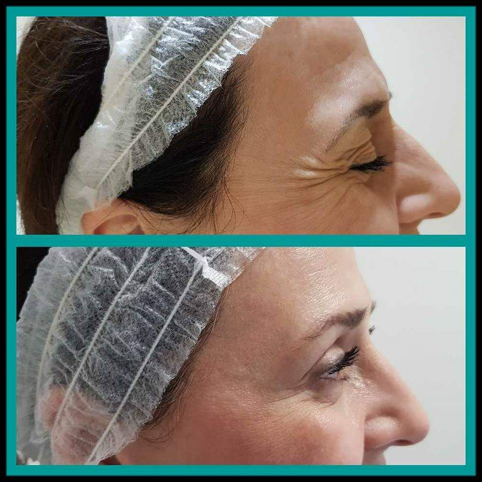 Rosalba Herrero Zerpa-392