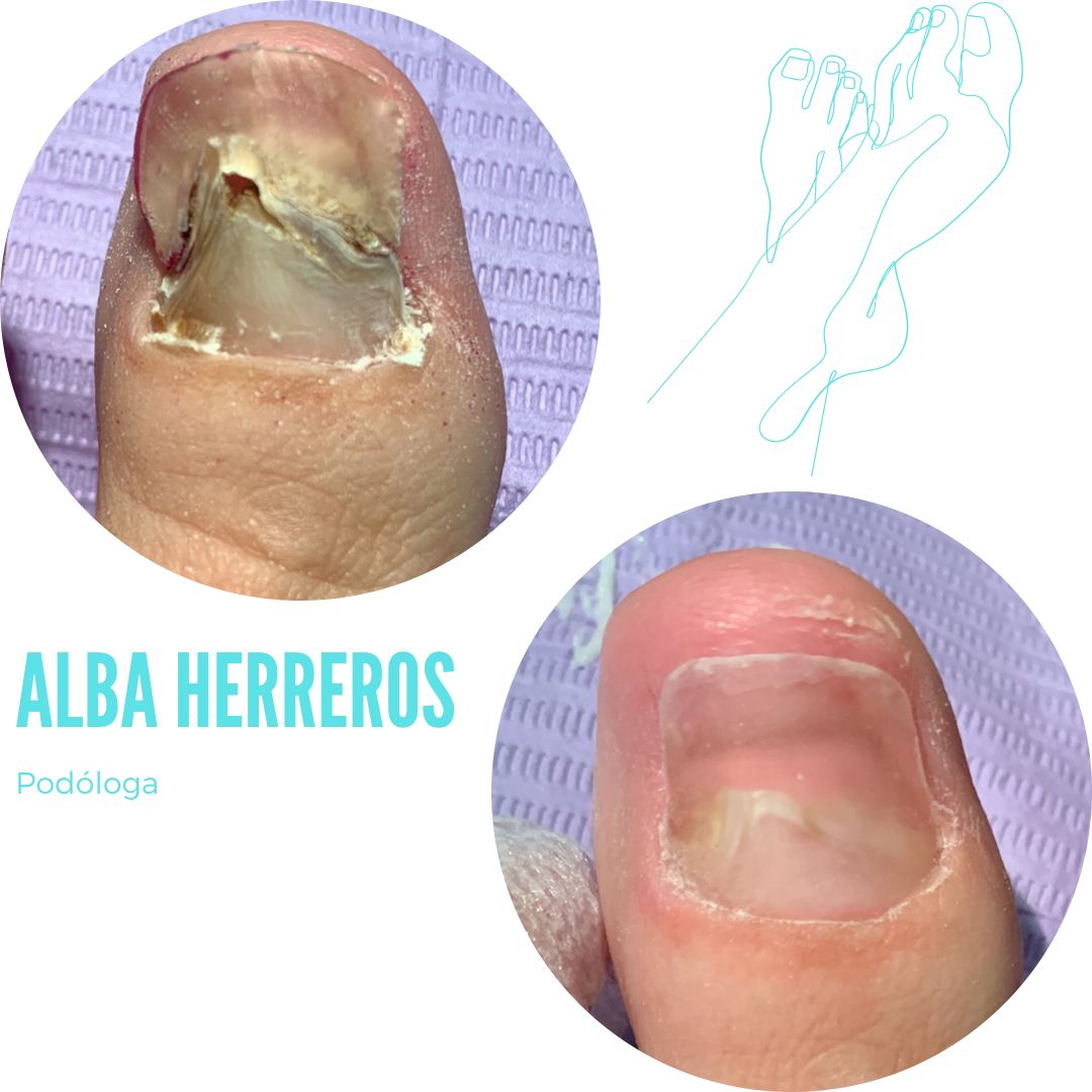 Alba Herreros Gómez-11