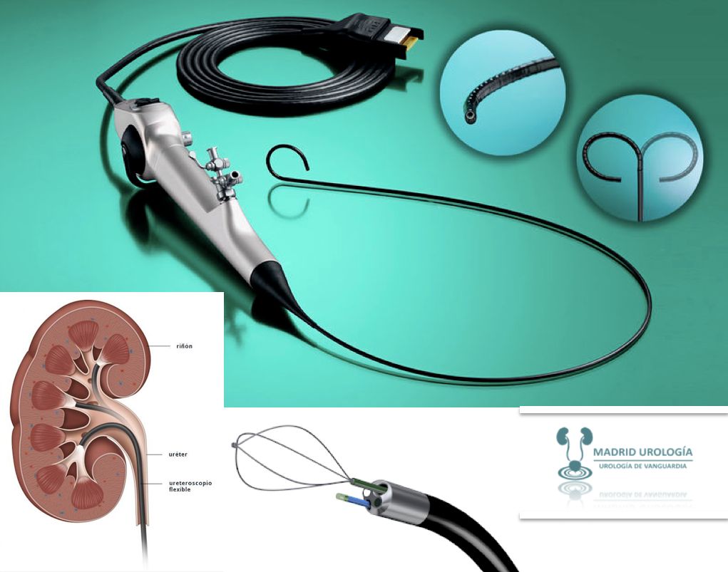 Luis Fernando Susaníbar Napurí-34