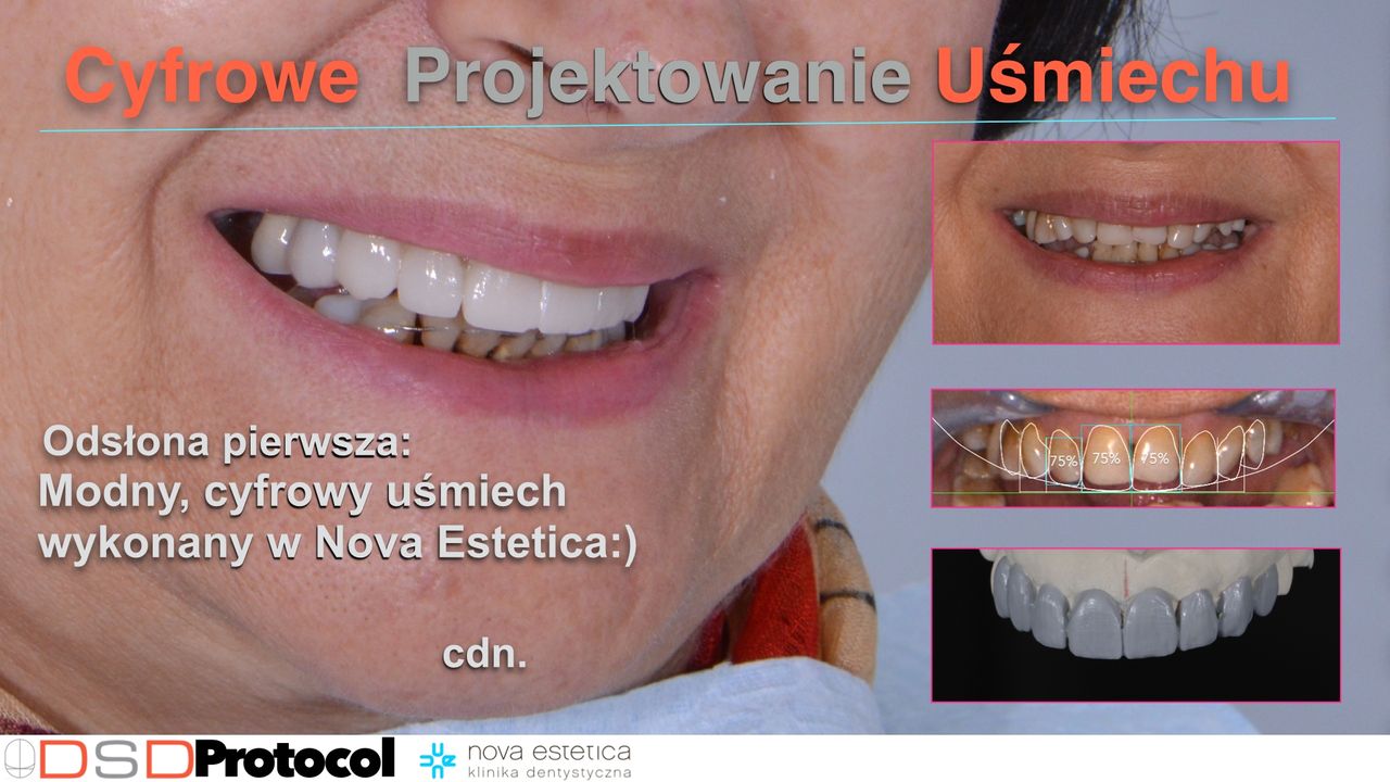 Sebastian Łapiński-5