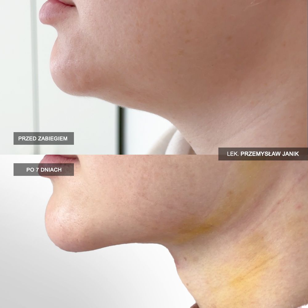 Przemysław Janik-27