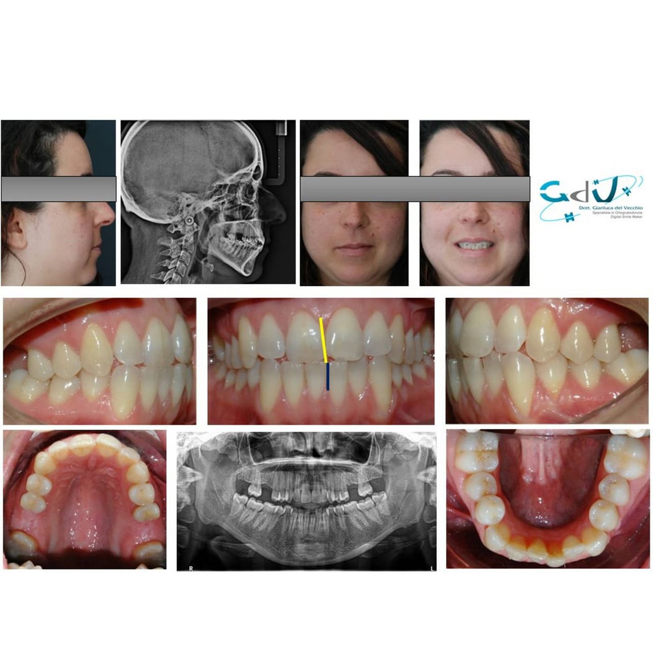 Gianluca Del Vecchio-100